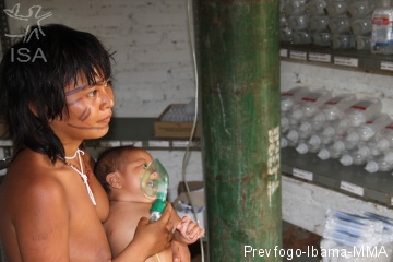 Crianças indígenas sofrem especialmente com os efeitos da fumaça.  Na imagem, criança da TI Yanomami recebe nebulização | Prevfogo-Ibama-MMA